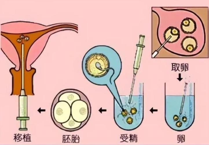 国内怎么供卵-国内供卵方式详解