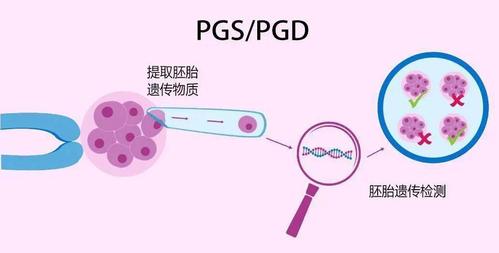 有正规的试管代怀吗【正规试管代怀孕:医学技术助力实现生育梦】