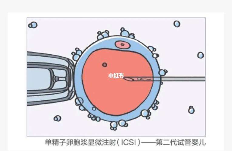 国内试管代怀好不好(国内试管代怀：好不好？)