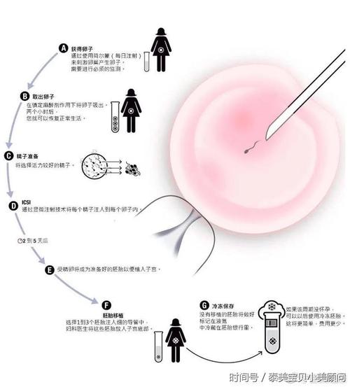 正规试管代怀-正规试管代怀:科学技术助力实现生育梦